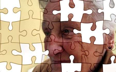 Alzheimer